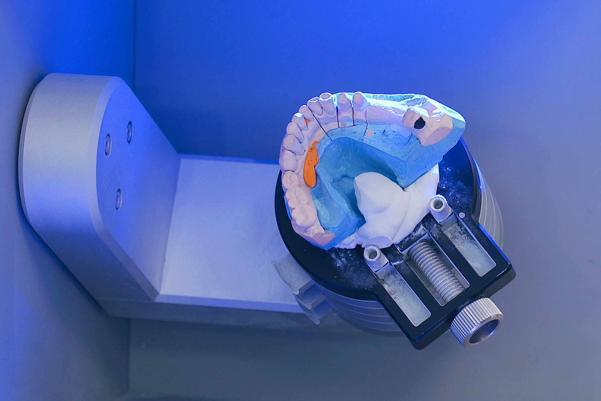 3D scanning dental models and dentures in an innovative lab
